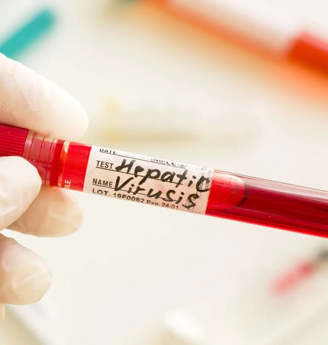 Infectious Diseases